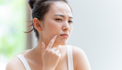 京都でニキビ跡治療が人気のクリニック9院！レーザー治療が良い？市販薬か皮膚科の治療の違いは？